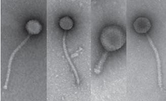 Microscopic image of a virus